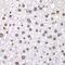 DNA Topoisomerase I antibody, GTX64445, GeneTex, Immunohistochemistry paraffin image 