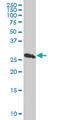 Proteasome Subunit Beta 10 antibody, LS-C198017, Lifespan Biosciences, Western Blot image 