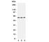 Potassium Voltage-Gated Channel Subfamily C Member 1 antibody, R31422, NSJ Bioreagents, Western Blot image 