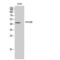 VPS26, Retromer Complex Component B antibody, LS-C386646, Lifespan Biosciences, Western Blot image 