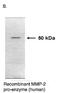 Matrix Metallopeptidase 2 antibody, orb109157, Biorbyt, Immunohistochemistry paraffin image 