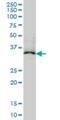 Microtubule Associated Protein RP/EB Family Member 2 antibody, H00010982-M03, Novus Biologicals, Western Blot image 