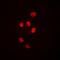 Histone Deacetylase 1 antibody, LS-C352326, Lifespan Biosciences, Immunofluorescence image 