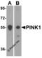 Serine/threonine-protein kinase PINK1, mitochondrial antibody, 7859, ProSci, Western Blot image 