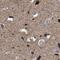 Mitochondrial Trans-2-Enoyl-CoA Reductase antibody, NBP1-85659, Novus Biologicals, Immunohistochemistry paraffin image 
