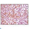 Synuclein Alpha antibody, LS-C814077, Lifespan Biosciences, Immunohistochemistry paraffin image 
