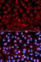 Histone Deacetylase 6 antibody, LS-C746968, Lifespan Biosciences, Immunofluorescence image 