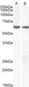 Proprotein Convertase Subtilisin/Kexin Type 9 antibody, 46-147, ProSci, Western Blot image 