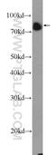 BCL6 Transcription Repressor antibody, 21187-1-AP, Proteintech Group, Western Blot image 