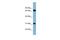 HIRA Interacting Protein 3 antibody, GTX44859, GeneTex, Western Blot image 