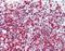 ArfGAP With Coiled-Coil, Ankyrin Repeat And PH Domains 2 antibody, orb88098, Biorbyt, Immunohistochemistry paraffin image 