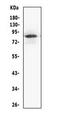 Minichromosome Maintenance Complex Component 5 antibody, LS-C312808, Lifespan Biosciences, Western Blot image 
