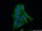 Kaptin, Actin Binding Protein antibody, 16094-1-AP, Proteintech Group, Immunofluorescence image 