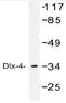 Distal-Less Homeobox 4 antibody, AP20536PU-N, Origene, Western Blot image 