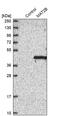 Methionine Adenosyltransferase 2B antibody, PA5-58074, Invitrogen Antibodies, Western Blot image 