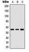 Receptor Interacting Serine/Threonine Kinase 3 antibody, LS-C358287, Lifespan Biosciences, Western Blot image 