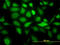Keratin 20 antibody, LS-B4527, Lifespan Biosciences, Immunofluorescence image 