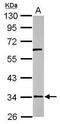RNA Pseudouridine Synthase D3 antibody, GTX122993, GeneTex, Western Blot image 