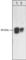 3-Phosphoinositide Dependent Protein Kinase 1 antibody, PM1461, ECM Biosciences, Western Blot image 