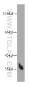 HtrA Serine Peptidase 1 antibody, 55011-1-AP, Proteintech Group, Western Blot image 