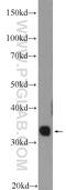 Tetrapeptide Repeat Homeobox 1 antibody, 25834-1-AP, Proteintech Group, Western Blot image 