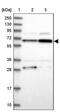 Cytoplasmic Polyadenylation Element Binding Protein 4 antibody, PA5-58371, Invitrogen Antibodies, Western Blot image 