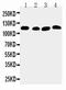 ATPase Sarcoplasmic/Endoplasmic Reticulum Ca2+ Transporting 2 antibody, PA5-78836, Invitrogen Antibodies, Western Blot image 