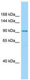 Sperm Associated Antigen 1 antibody, TA338243, Origene, Western Blot image 
