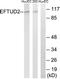 Elongation Factor Tu GTP Binding Domain Containing 2 antibody, LS-C119601, Lifespan Biosciences, Western Blot image 