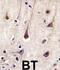 Phosphoinositide-3-Kinase Regulatory Subunit 2 antibody, abx033829, Abbexa, Immunohistochemistry frozen image 