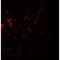 C-C Motif Chemokine Receptor 7 antibody, LS-C201180, Lifespan Biosciences, Immunofluorescence image 
