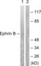 Ephrin B1 antibody, LS-C117521, Lifespan Biosciences, Western Blot image 