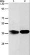 ADP-Ribosylhydrolase Like 2 antibody, LS-C402910, Lifespan Biosciences, Western Blot image 