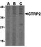 C1q And TNF Related 2 antibody, orb74633, Biorbyt, Western Blot image 