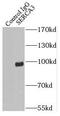 ATPase Sarcoplasmic/Endoplasmic Reticulum Ca2+ Transporting 3 antibody, FNab07733, FineTest, Immunoprecipitation image 