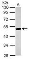 ILK Associated Serine/Threonine Phosphatase antibody, GTX116528, GeneTex, Western Blot image 