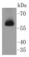 Checkpoint Kinase 2 antibody, NBP2-67595, Novus Biologicals, Western Blot image 