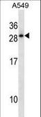 Homeobox D12 antibody, LS-C157816, Lifespan Biosciences, Western Blot image 