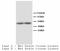 Tryptophan Hydroxylase 1 antibody, LS-C171009, Lifespan Biosciences, Western Blot image 
