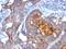 Extracellular Matrix Protein 1 antibody, M02861, Boster Biological Technology, Immunohistochemistry paraffin image 