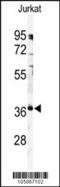 Protein Phosphatase 6 Catalytic Subunit antibody, 63-490, ProSci, Western Blot image 