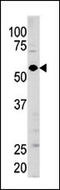 Guanylate Cyclase 1 Soluble Subunit Alpha 1 antibody, 62-679, ProSci, Western Blot image 