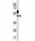 Serine/threonine-protein kinase Sgk1 antibody, F46903-0.4ML, NSJ Bioreagents, Western Blot image 