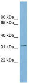 Transmembrane protein 163 antibody, TA339569, Origene, Western Blot image 