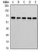 CBFA2/RUNX1 Partner Transcriptional Co-Repressor 2 antibody, orb341222, Biorbyt, Western Blot image 