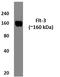Fms Related Tyrosine Kinase 3 antibody, GTX52747, GeneTex, Western Blot image 