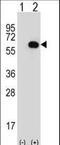 Glycerol Kinase antibody, LS-C166490, Lifespan Biosciences, Western Blot image 