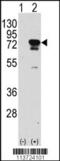 Eukaryotic Translation Initiation Factor 4B antibody, 60-585, ProSci, Western Blot image 