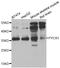 Pyrroline-5-Carboxylate Reductase 1 antibody, STJ29039, St John