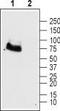 Glutamate Metabotropic Receptor 6 antibody, TA328841, Origene, Western Blot image 